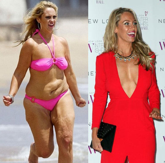 Josie Gibson weight loss