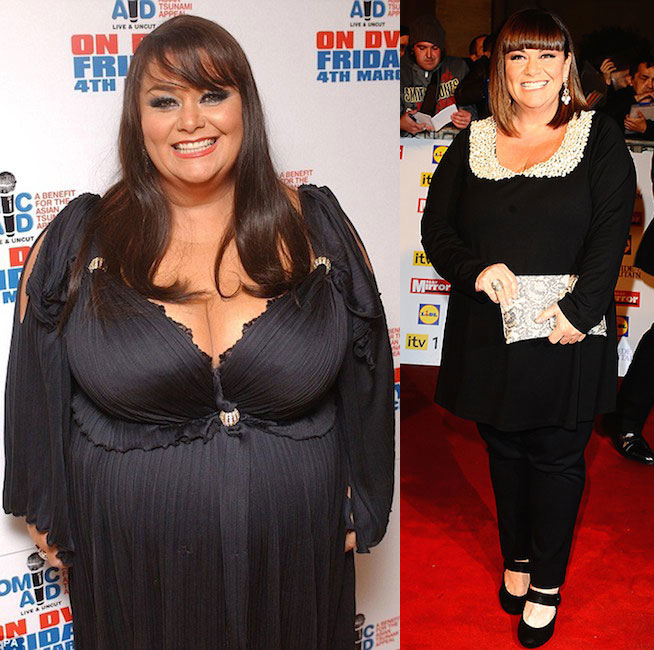 Dawn French Weight Loss - Lost Massive Seven and Half ...