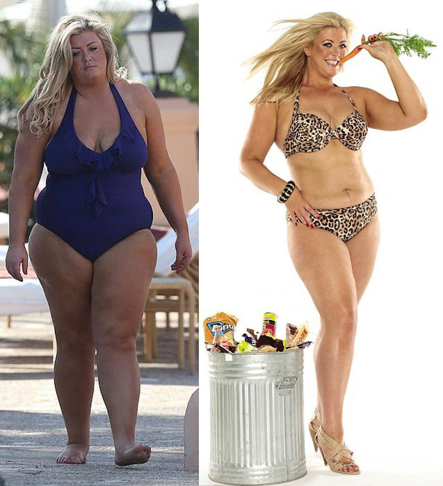 Gemma Collins Makeover Journey From Being Overweight To