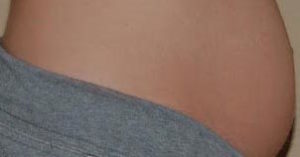 Bloating - Featured Image