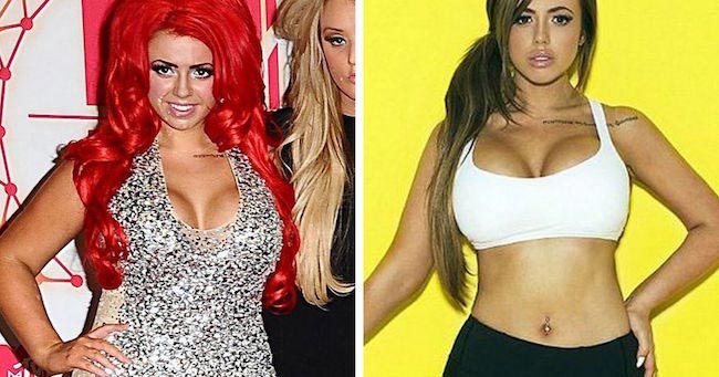 Holly Hagan before and after