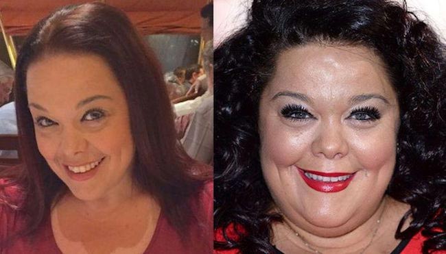 Lisa Riley face changes