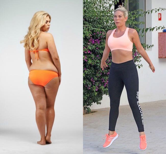 Frankie Essex before and after