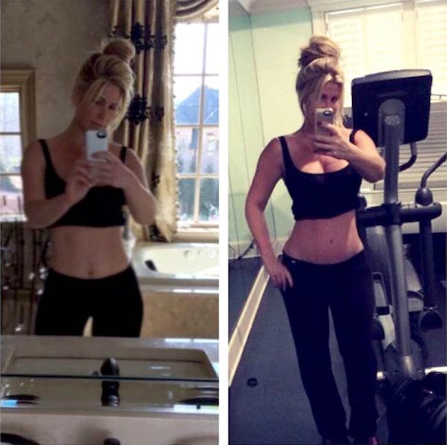 Kim Zolciak showing off her before and after pic of tummy tuck
