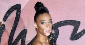 Winnie Harlow - Featured Image