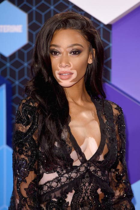 Winnie Harlow at MTV Europe Music Awards 2016