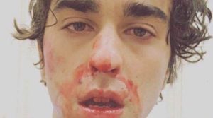 Alex Wolff Healthy Celeb