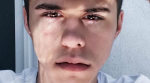 Jackson Krecioch Healthy Celeb