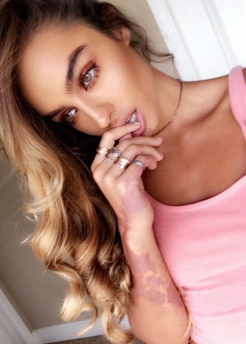 Sommer Ray showing her birth mark in a selfie as seen in December 2017