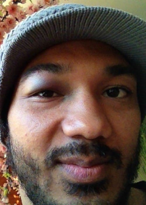 Benson Henderson showing his injury in a selfie in October 2013