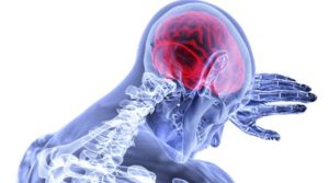 Best Foods to Eat after a Stroke