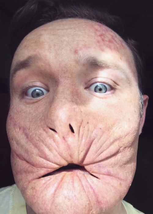 Ian Colletti in a selfie in his character disguise as Arseface in Preacher in April 2018