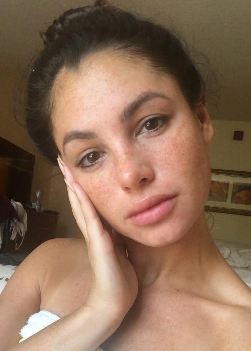 Kayla Fitz as seen while taking a no-makeup selfie, showing her freckles, in Beverly Hills, California in September 2018