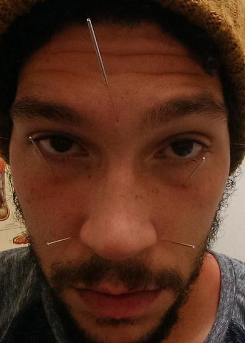 Joel Fry as seen in a selfie taken while getting accupuncture for the face in August 2015