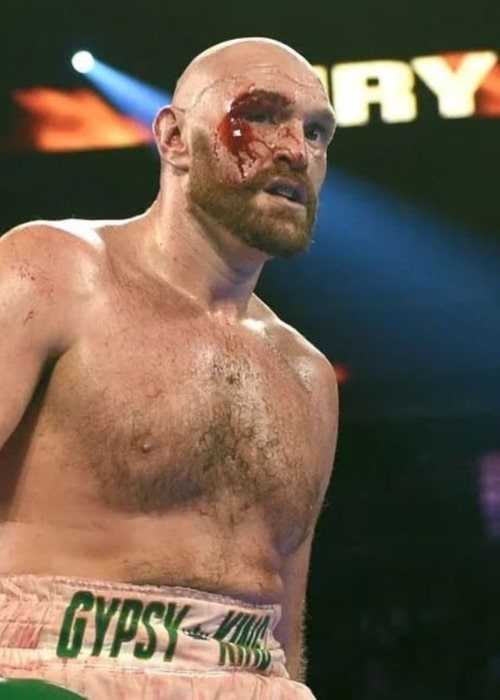 Tyson Fury as seen in an Instagram Post in September 2019