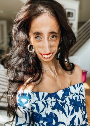 Lizzie Velásquez Height, Weight, Age, Family, Facts, Education, Biography