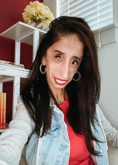 Lizzie Velasquez Has A Boyfriend