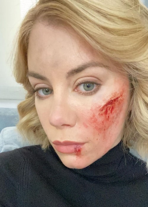 Jennifer Holland in a selfie taken in February 2022, with a cut and bruise makeup