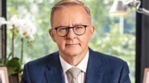 Anthony Albanese