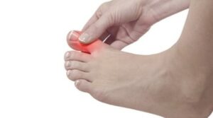 A person holding their painful big toe that is highlighted in red